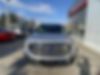 1FTEX1EP7JFC21087-2018-ford-f-150-1